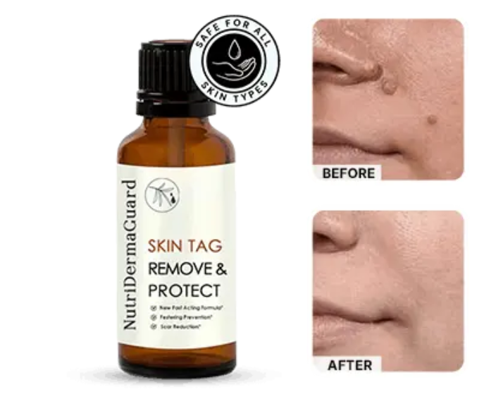 Nutri Derma Guard-review